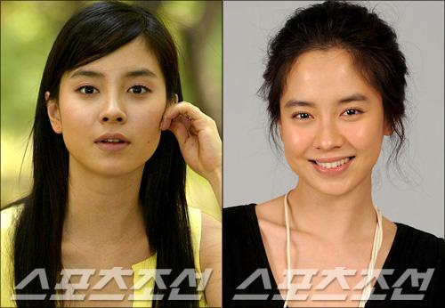 韩国无整容女星排行榜,整容死掉的(韩国整容死亡率)