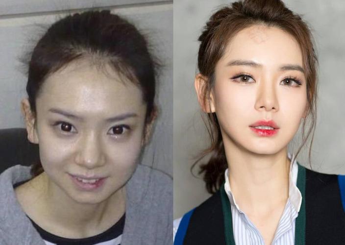 明星整形失败,整容失败的人(为什么有的明星整容成功有的失败了)