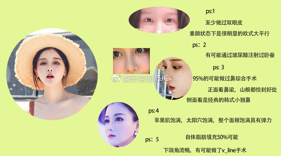 滕雨佳整容前后对比照片(滕雨佳素颜) 滕雨佳整容前后对比照片(滕雨佳素颜)