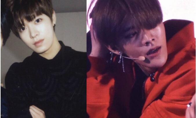 中本悠太下巴怎么了(中本悠太整过容吗)