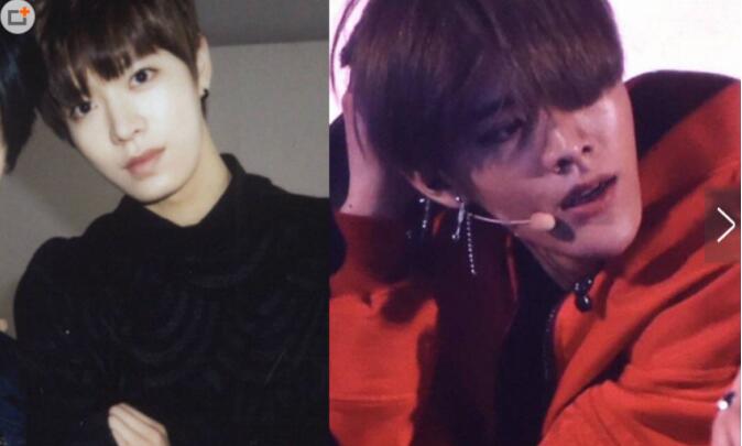 中本悠太下巴怎么了(中本悠太整过容吗)