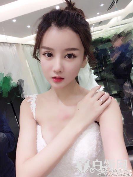 滕雨佳整容前后对比图(滕雨佳素颜) 滕雨佳整容前后对比图(滕雨佳素颜)