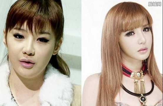 朴春整容前老照片曝光(朴春之前的照片) 朴春整容前老照片曝光(朴春之前的照片)