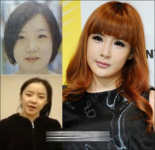 朴春整容前老照片曝光(朴春之前的照片)