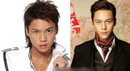 男星整容，男生整容一次大概多少钱(男的整容多少钱)