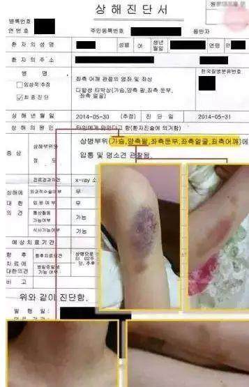 家暴事件后金贤重现状怎么样(金贤重事件真相)