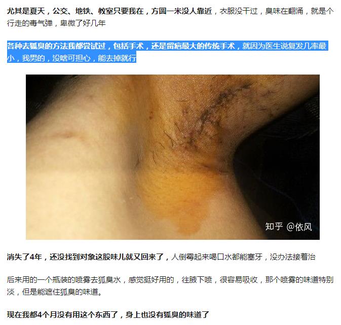 迪丽热巴有狐臭吗?有狐臭的女生都很漂亮真(为什么狐臭女孩很漂亮) 迪丽热巴有狐臭吗?有狐臭的女生都很漂亮真(为什么狐臭女孩很漂亮)