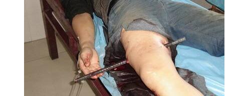 欢乐颂2曲筱绡说的三刀六洞是什么意思？三