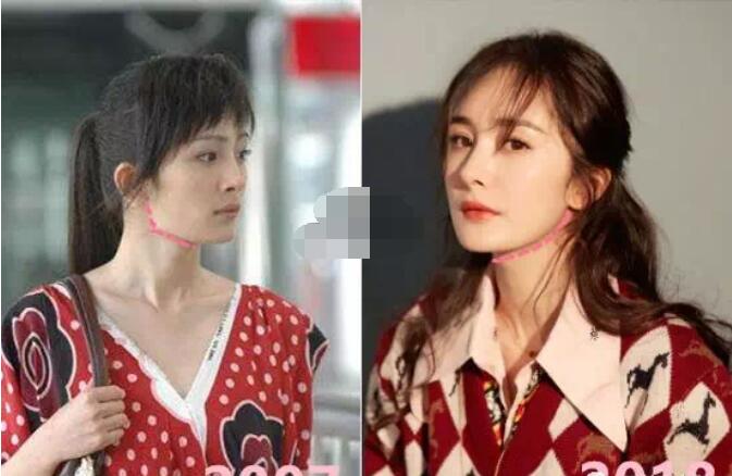 杨幂下牙只有6颗一笑没有后槽牙真假?是为 杨幂下牙只有6颗一笑没有后槽牙真假?是为