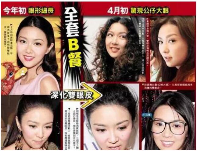 薛凯琪眼袋本来很重怎么没了?薛凯琪病重是 薛凯琪眼袋本来很重怎么没了?薛凯琪病重是