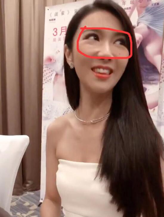 薛凯琪眼袋本来很重怎么没了?薛凯琪病重是 薛凯琪眼袋本来很重怎么没了?薛凯琪病重是