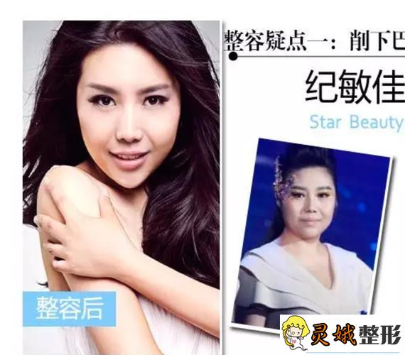 纪敏佳最新照片,超女纪敏佳图片(纪敏佳超女海选视频)