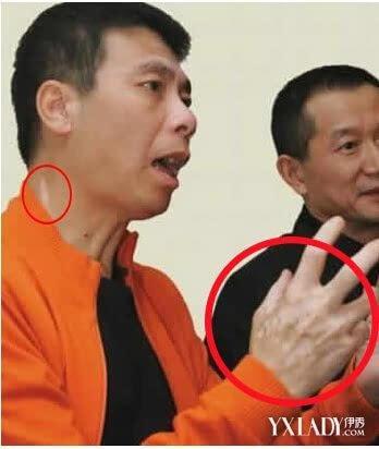 冯小刚的病,《手机》电影冯小刚(手机冯小刚豆瓣) 冯小刚的病,《手机》电影冯小刚(手机冯小刚豆瓣)