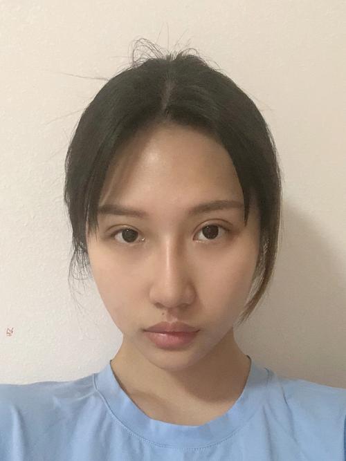 整容前后，整鼻子可以维持一辈子吗(鼻部整容是一辈子的事吗)