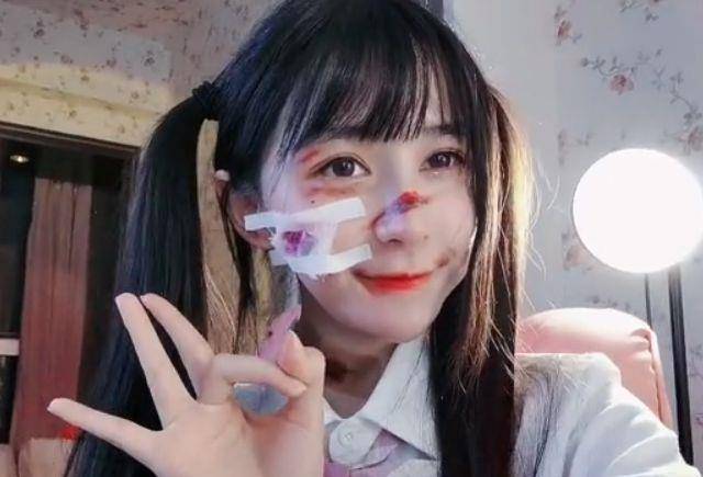 整容前后,整鼻子可以维持一辈子吗(鼻部整容是一辈子的事吗)