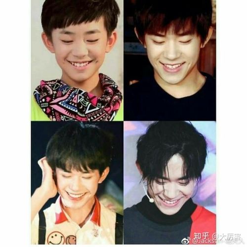 angelababy隆胸,abb(Angelababy深v开胸)