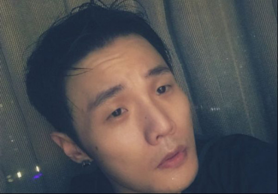 李荣浩的眼睛天生就这么小吗？李荣浩怎么出(李荣浩 小眼睛)