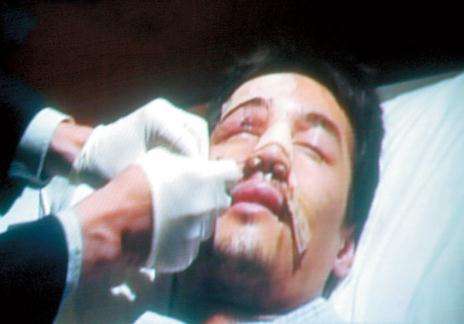 胡歌车祸原因是什么？胡歌车祸现场图片曝光(胡歌车祸是怎么回事)