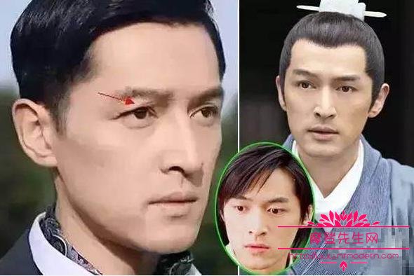 胡歌车祸原因是什么？胡歌车祸现场图片曝光(胡歌车祸是怎么回事)