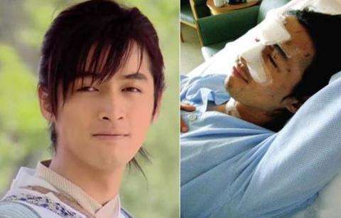 胡歌车祸原因是什么?胡歌车祸现场图片曝光(胡歌车祸是怎么回事)