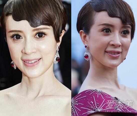 金巧巧整容,金巧巧嘴巴怎么回事(金巧巧 嘴巴)