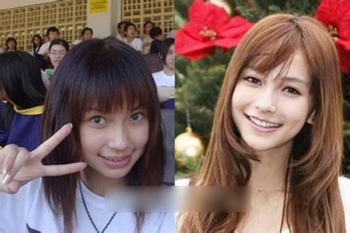 杨颖整容了么,杨颖和黄晓明为什么(杨颖到底有没有整容不许撒谎) 杨颖整容了么,杨颖和黄晓明为什么(杨颖到底有没有整容不许撒谎)