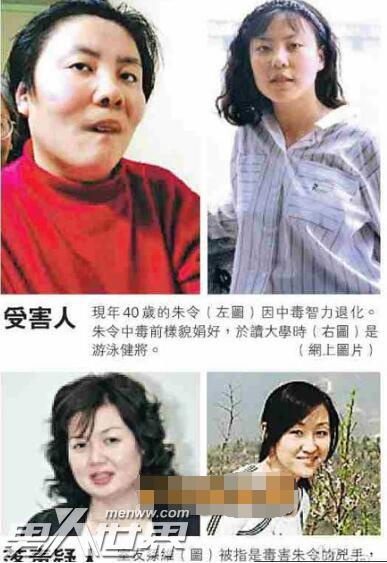 铊中毒朱令照片，潘晶晶铊中毒现状(女子铊中毒之谜)