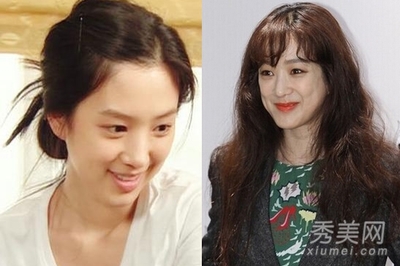 郑丽媛整容前后对比图