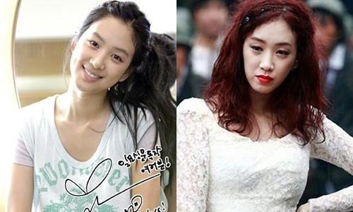 郑丽媛整容前后对比图