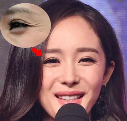 杨幂的脸撑不了多久了是什么梗?王牌对王牌