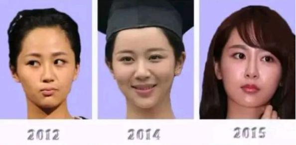 杨紫为什么叫硅胶紫(杨紫的硅胶感豆瓣) 杨紫为什么叫硅胶紫(杨紫的硅胶感豆瓣)