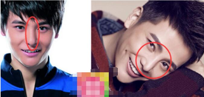 孙坚鼻子整形了吗(孙坚是不是整过容)