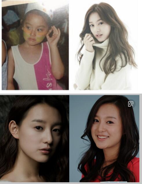 金智媛整容前后对比图(金智妮整容前后照片) 金智媛整容前后对比图(金智妮整容前后照片)