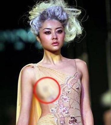 熊黛林整容前丑照曝光(熊黛林长得怎么样) 熊黛林整容前丑照曝光(熊黛林长得怎么样)