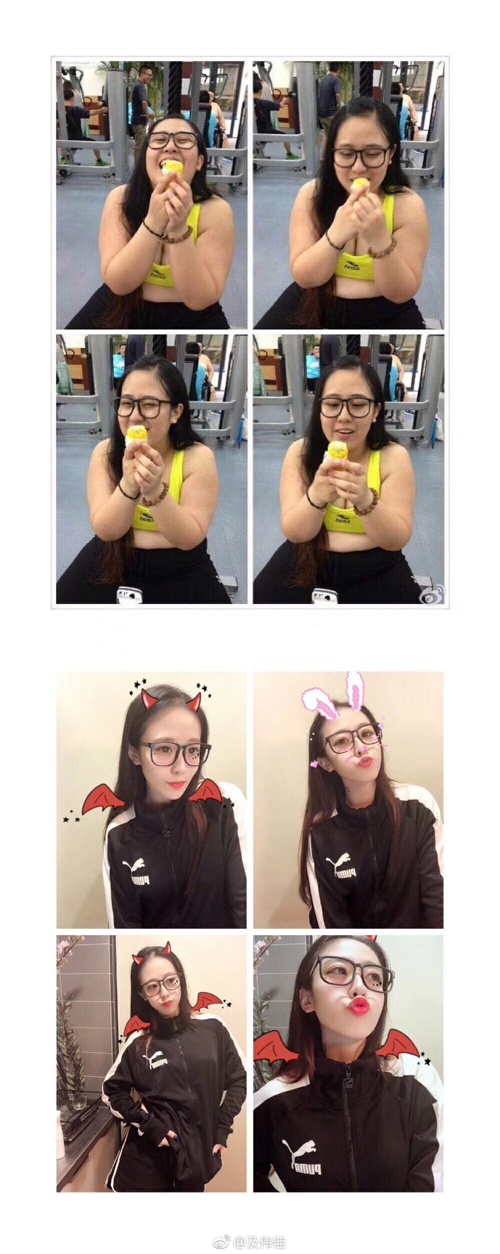 最美女胖子及伟佳切胃是真的吗 最美女胖子及伟佳切胃是真的吗