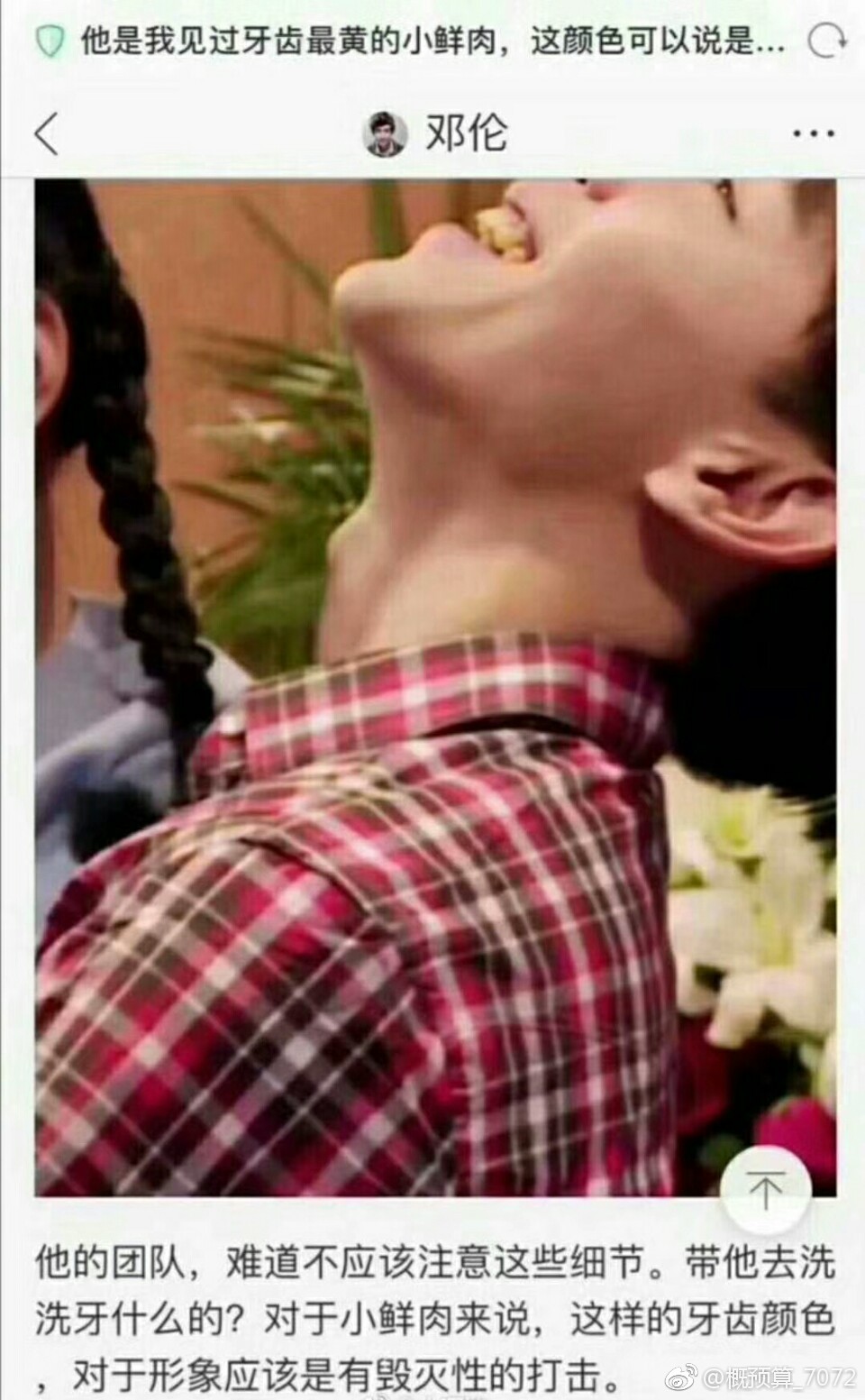 邓伦整牙前后对比图(邓伦下颌线) 邓伦整牙前后对比图(邓伦下颌线)