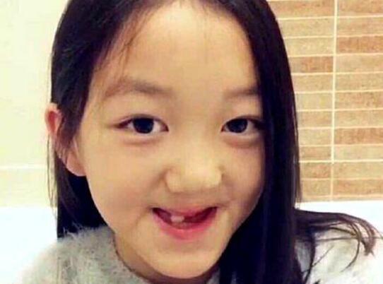 李嫣说话清楚吗?她的上面长不出牙真的假的 李嫣说话清楚吗?她的上面长不出牙真的假的