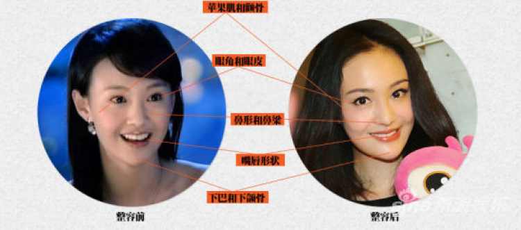 郑爽开眼角前后对比照(郑爽单眼皮)