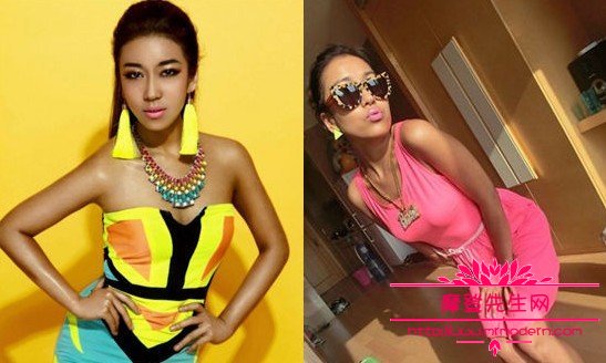 吉克隽逸为什么皮肤那么黑？吉克隽逸有什么(吉克隽逸全身都是黑的吗)