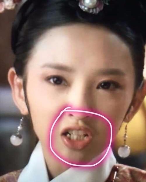 唐艺昕牙齿整容前是什么样？唐艺昕从面相看