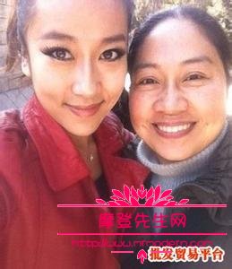 吉克隽逸为什么皮肤那么黑？吉克隽逸有什么(吉克隽逸全身都是黑的吗)