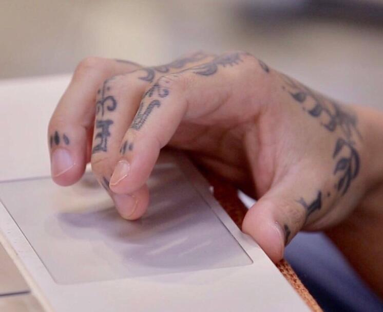 蔡维泽的手怎么了(蔡维泽是谁)