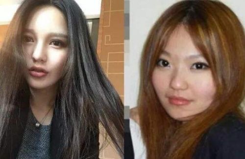 周扬青卸妆后的真实素颜颜值照片(周扬青整容前照片)