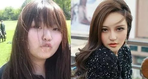 周扬青卸妆后的真实素颜颜值照片(周扬青整容前照片)