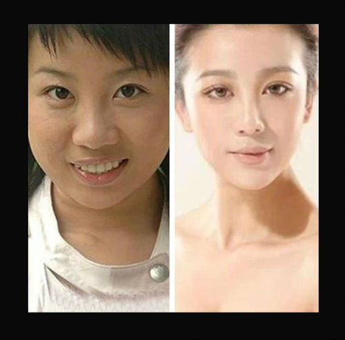 张冬玲整容前后对比照(张冬玲近照)