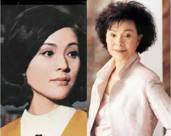 归亚蕾双眼皮是割的吗 归亚蕾双眼皮是割的吗