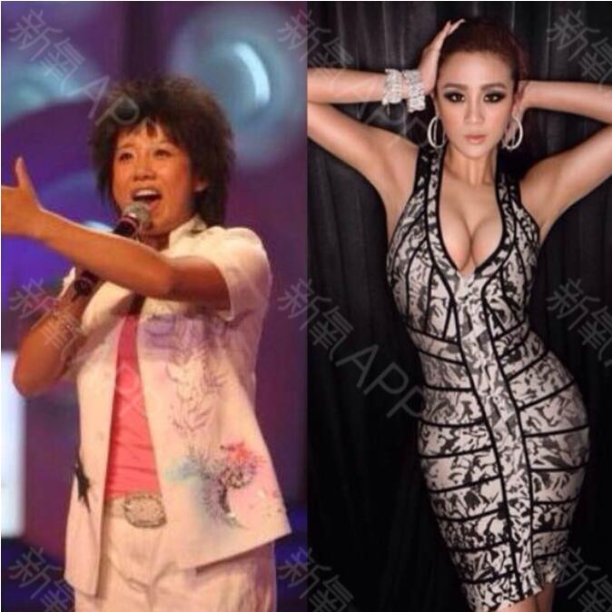 张冬玲整容前后对比照(张冬玲近照)