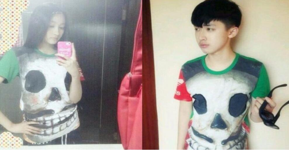 张逸杰脸怎么变了被怀疑整容(张逸杰整了哪里)