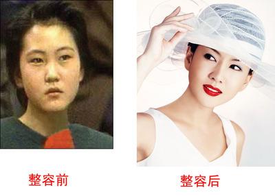 金南珠整容前后对比图(金南珠近照)