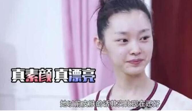 宋轶皮肤真有那么好吗为什么这么白